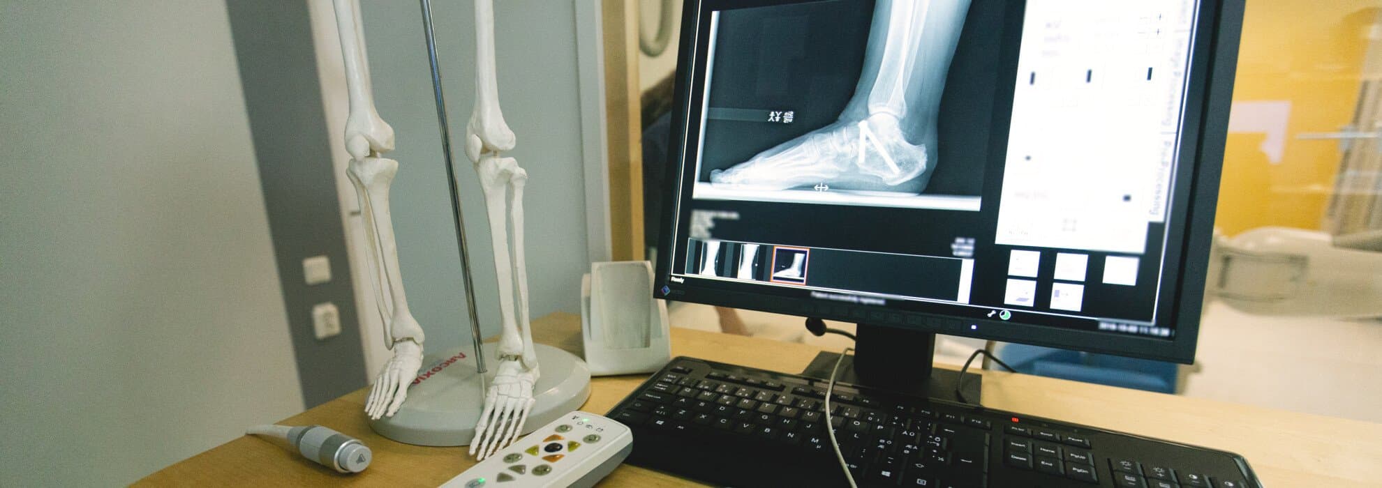 Röntgenbild på en datorskärm