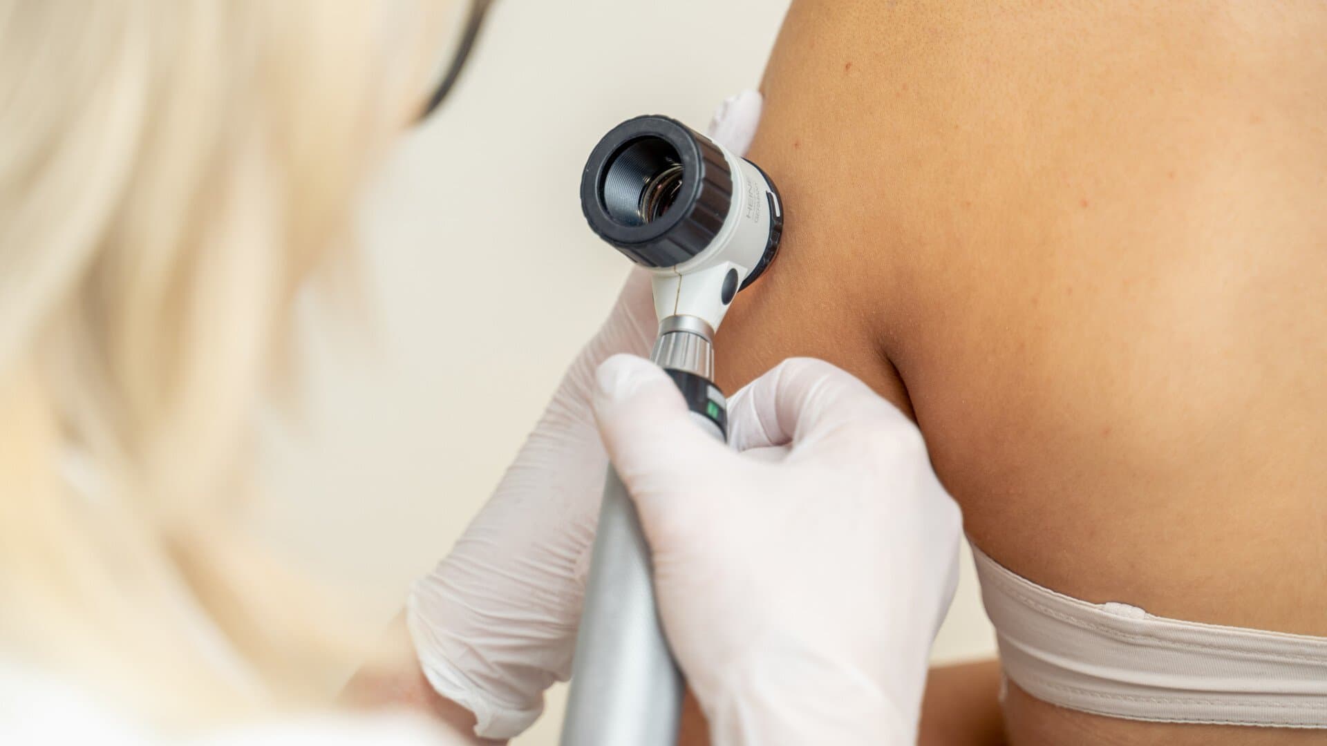 läkare undersöker hud läkare undersöker hud